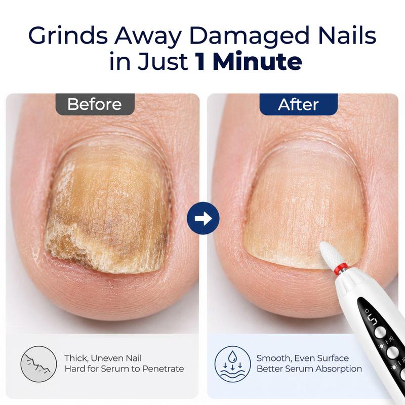 Havly Cordless Toenail Grooming Drill
