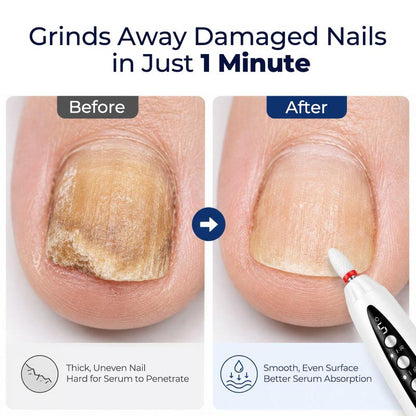 Havly Cordless Toenail Grooming Drill